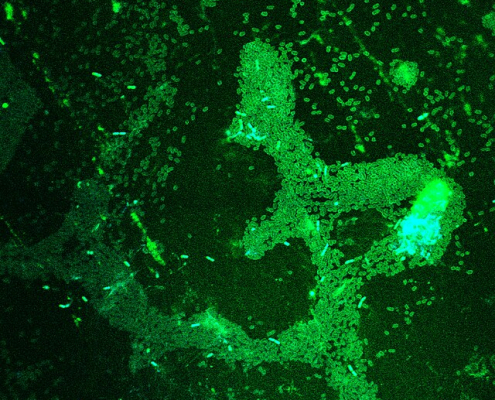 Biofilm preparation of Enterobacter and Listeria monocytogenes under a confocal microscope.